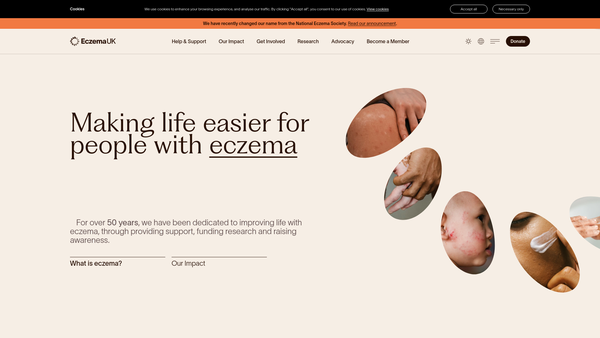 Screenshot of the National Eczema Society website