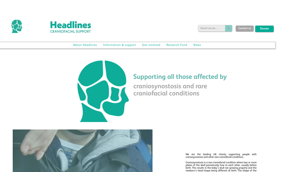 Screenshot of the Headlines Craniofacial Support website