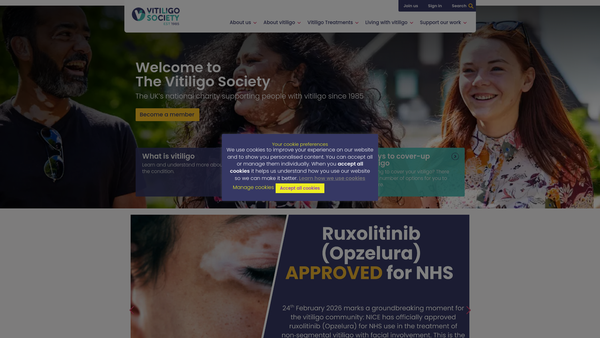 Screenshot of the The Vitiligo Society website