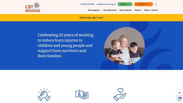 Screenshot of the Children's Burns Trust website