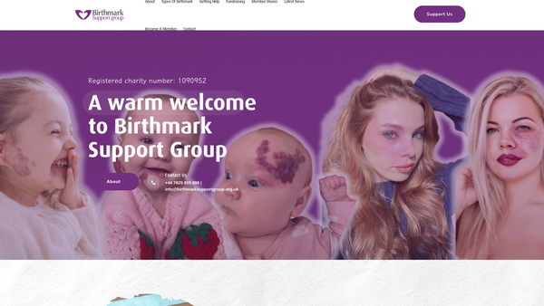 Screenshot of the The Birthmark Support Group website
