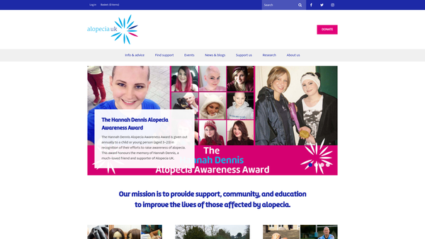 Screenshot of the Alopecia UK website