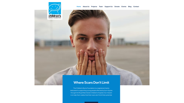 Screenshot of the Children's Burns Foundation- A Step Forward website