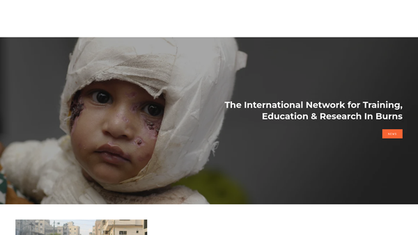 Screenshot of the Interburns Limited website