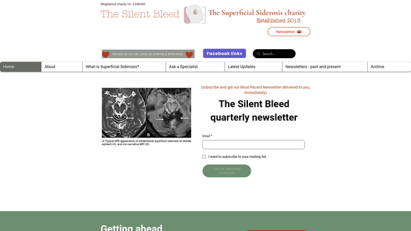 Screenshot of the Superficial Siderosis - The Silent Bleed website