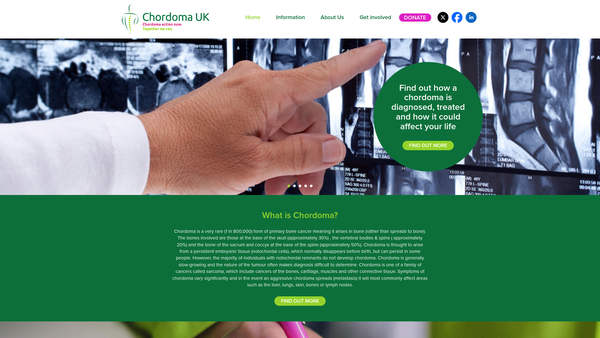 Screenshot of the Chordoma UK website
