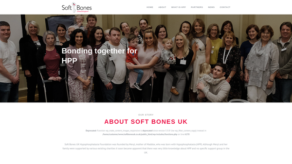 Screenshot of the Soft Bones UK Foundation website
