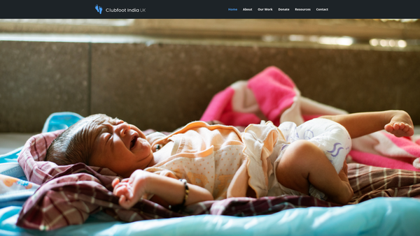 Screenshot of the Clubfoot India (UK) website