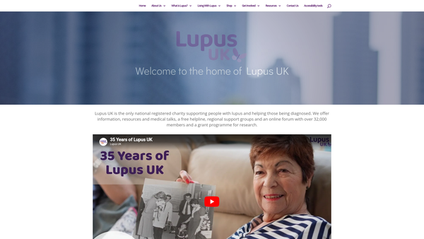 Screenshot of the Lupus UK website