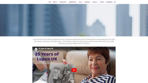 Screenshot of the Lupus UK website
